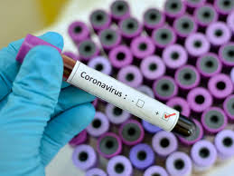 New Coronavirus Cases Drop in Pakistan for the 4th Week in a Row