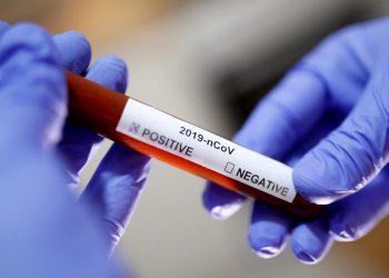 This Pakistani Startup Delivers Coronavirus Test Results in 15 Minutes for Just $12