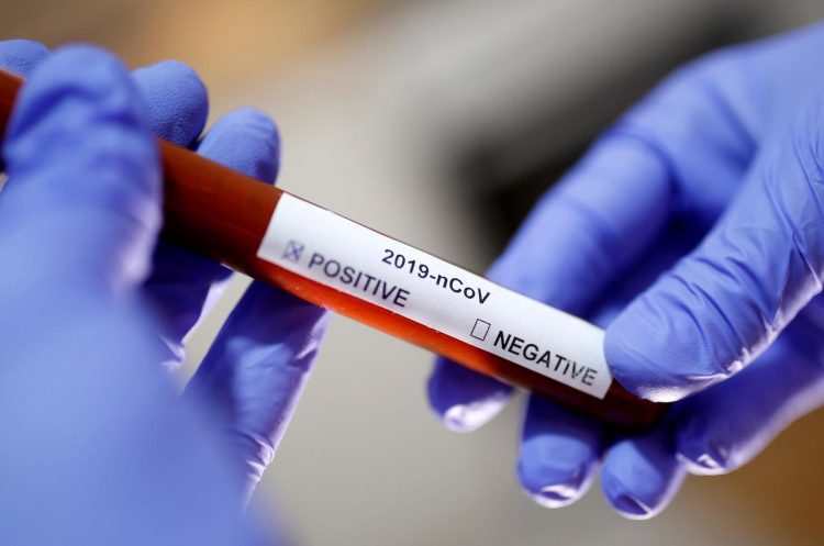 This Pakistani Startup Delivers Coronavirus Test Results in 15 Minutes for Just $12