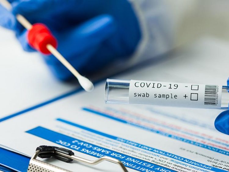 Alarms are raised as Islamabad reports the highest COVID-19 positivity ratio ever recorded