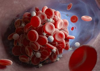 Six months after receiving Covid, risk of blood clots is higher