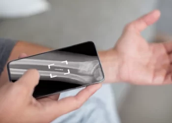 The implantable microchips that allow you to pay with your hand