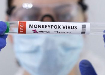 By an AKUH expert, there is no need to be worried about monkeypox virus