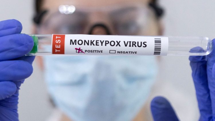 By an AKUH expert, there is no need to be worried about monkeypox virus