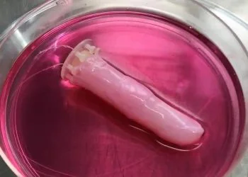 Scientists construct a self-healing robot finger with 'slightly sweaty' live skin
