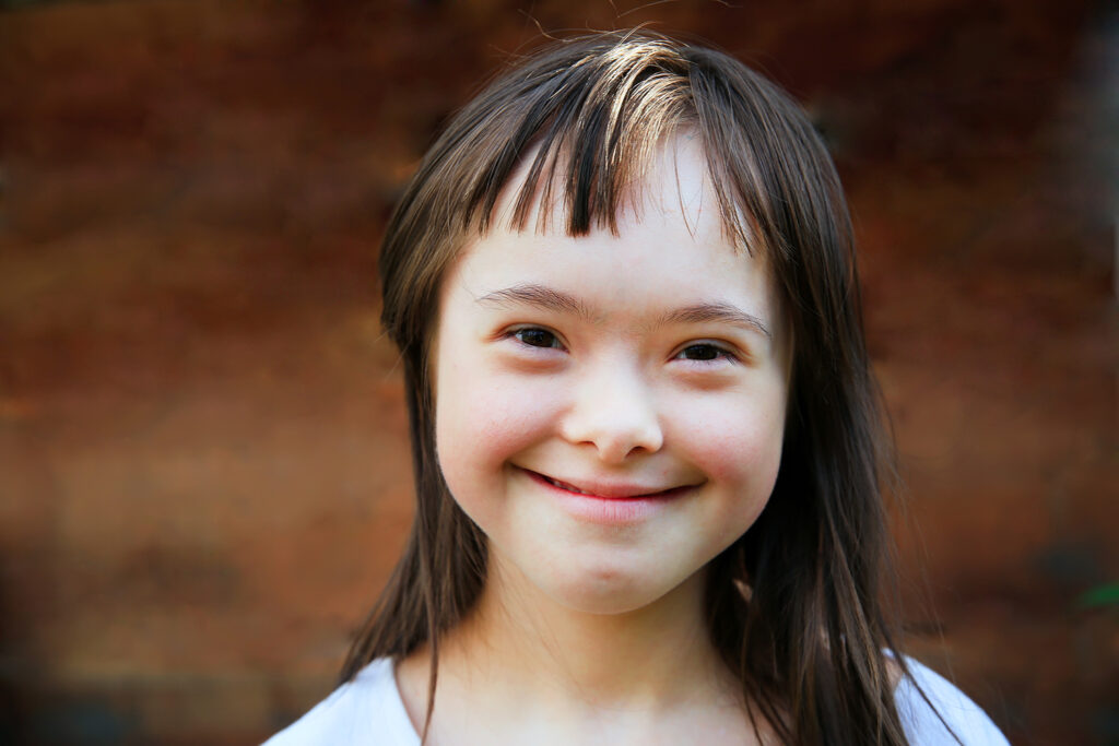 How To deal with behavior issues in children with Down Syndrome
