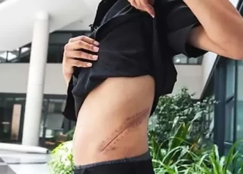 Red Cross: People Shouldn't Sell Their Kidneys for iPhones