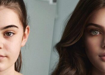 Is perfection just a filter away on Snapchat Dysmorphia?