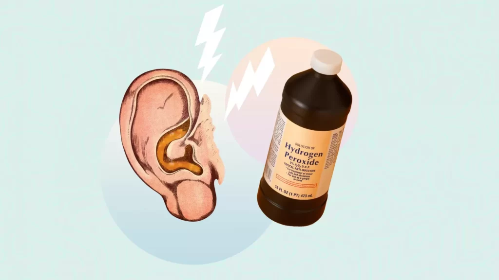 Hydrogen peroxide for earwax removal: Is it safe?