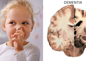Alzheimer's and dementia risk may rise with nose picking