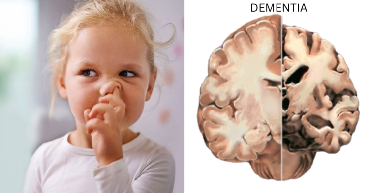 Alzheimer's and dementia risk may rise with nose picking