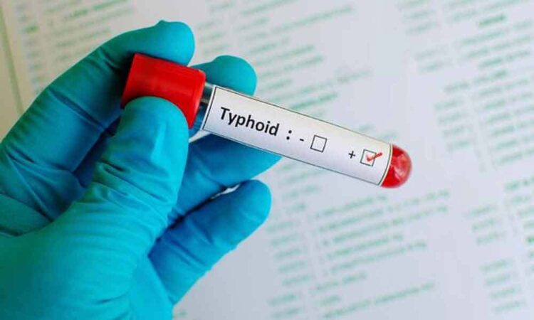 lots-of-xdr-typhoid-cases-in-karachi-has-increased