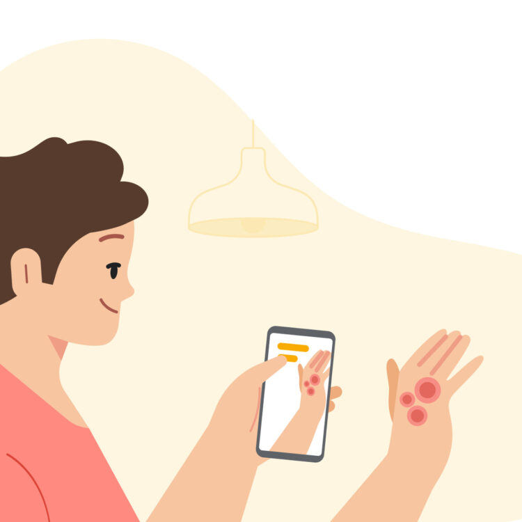 google-now-allows-you-to-diagnose-skin-diseases-at-home