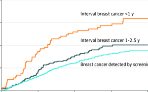 ai-transforms-breast-cancer-detection-by-cut-loads-half