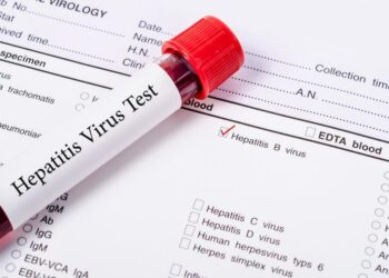 Massive Hepatitis case screenings take place in Rawalpindi