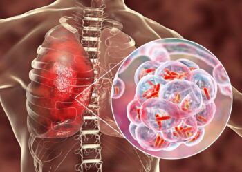 UK removes refugees off Bibby Stockholm barge due to health concerns