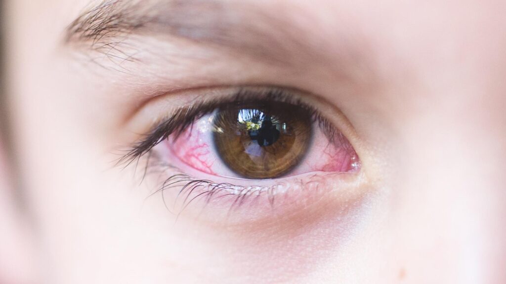 due-to-pink-eye-virus-punjab-announces-4-day-school-holiday