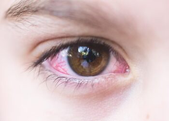 due-to-pink-eye-virus-punjab-announces-4-day-school-holiday