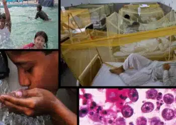 Naegleria risk: NIH's alert you need to know