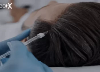 Exosomes Hair Loss Treatment at Shah Hassan Clinic