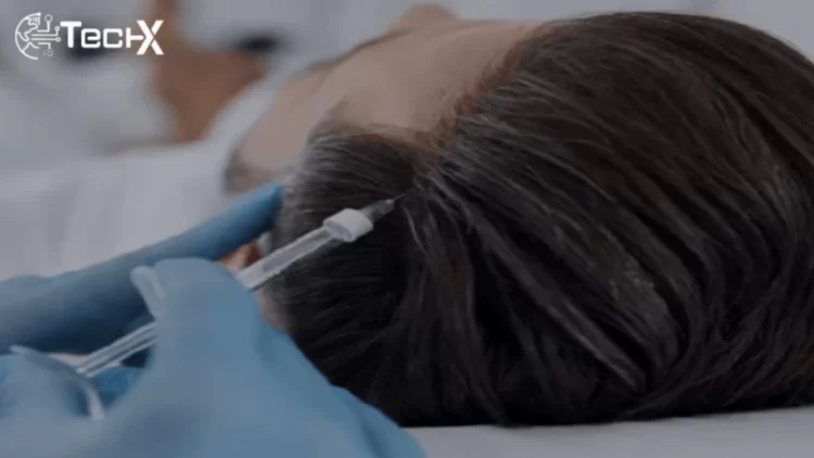 Exosomes Hair Loss Treatment at Shah Hassan Clinic