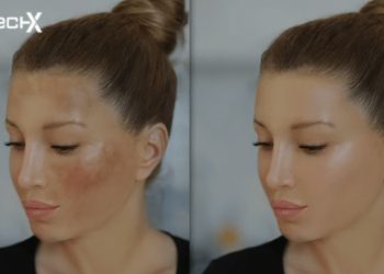 Dark Spots on Skin: A Health and Skincare Approach to Brighter, Clearer Skin