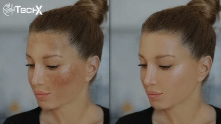 Dark Spots on Skin: A Health and Skincare Approach to Brighter, Clearer Skin