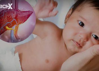 Hepatitis in Children: A Public Health Challenge That Demands Action