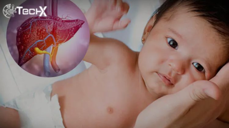 Hepatitis in Children: A Public Health Challenge That Demands Action